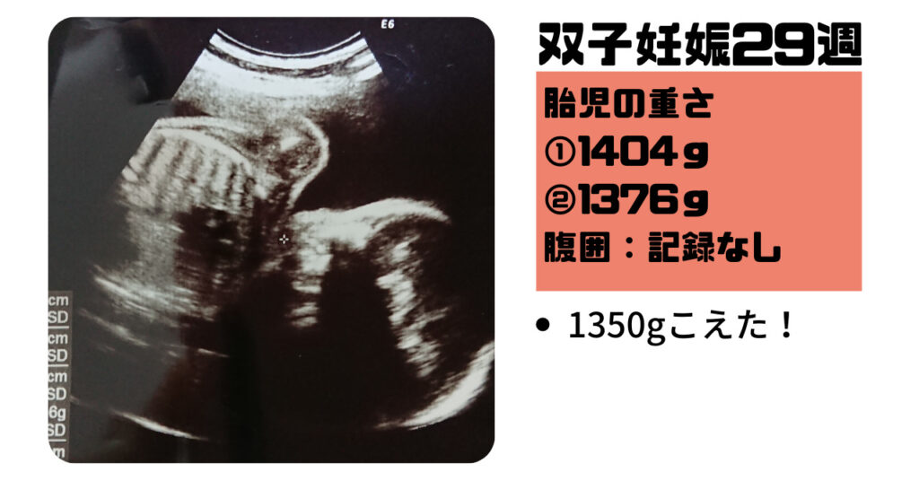 【双子妊娠8ヵ月（28週～31週）】管理入院開始と便秘の治療